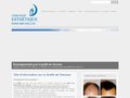 Greffe de cheveux avec Europe Esthétique