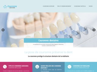 Toutes les informations sur les couronnes dentaires